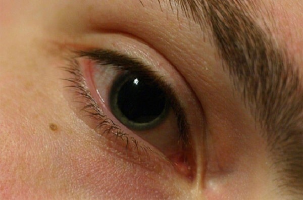 Các tế bào trong võng mạc của mắt bắt đầu xấu đi sau 40 tuổi